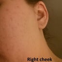 Right Side before