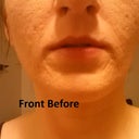 Front before