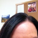 3 days after Botox