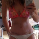 A bikini that I won't really wear until the scar is faded.