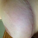 Left side 19 weeks