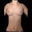 The 3D imaging that Dr Yates did. So awesome to see