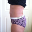 10 weeks left side (note belly button swelling)