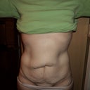 Before pic