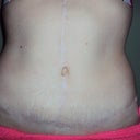 After pic, February, 2012