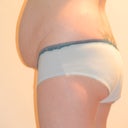left side