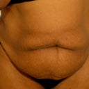 The creature tummy! Lock your doors, and hide....it's coming to get you!