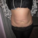 pre op front