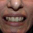 Before treatment