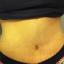 4 weeks PO. I look sexy hot! lol