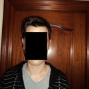 After 11 days. My right ear still pretty swollen and curved. I think the ear should draw a straight line, not a curve.
