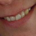 Before.