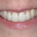 Tray 13/15