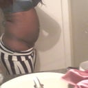 This is a side view pic taken on the 3/5/2013 and you can see some swelling but there is such a big difference as my before pics. You can see the shape coming in.
