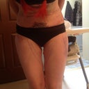 next day post op