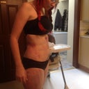 next day post op