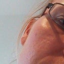 4 weeks after treatment left cheek
