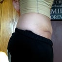 2 weeks and 2 days post.