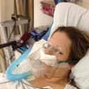 POST OP