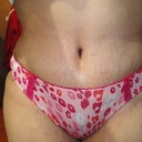 3 weeks post op.... Lovin my belly button... :)
