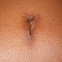 4 Weeks PO - Belly button. There's actually a stitch coming out at the top, but it's invisible in the pics and to me--I can only feel it except when I catch it with tweezers.