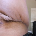 4 Weeks PO -- right side. Double-ugh.