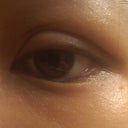 Left eye with random crease