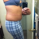 Side Pre-Op