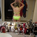 before hip and thigh lipo back shot