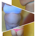 my before pics . this is the only way i could upload it . 2 more weeks