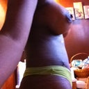 Right side 3 weeks post op