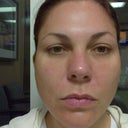 morning of surgery 7/7/11