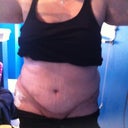 swelling from the front...left side and a funny area above pubic region...think it will go away or is it cause for concern?
