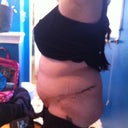 swelling day 23 from the left side