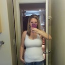 13 days post op-- in my jeans already!! front view looks better than side view