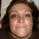 Before blue peel