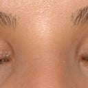 Before - eyes closed