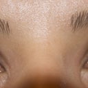 After eyes open