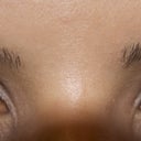 After eyes open