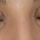 After eyes open