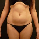 Before pictures. Provided by Simon Lee Aesthetic clinic