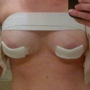 Post Surgery Day 1!
