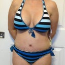 4 weeks post op