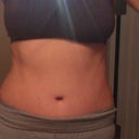 3 month post op