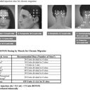 Chronic Migraine Botox Injection Sites