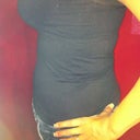 2 weeks post op and 1 Day

wearing Jeans side view