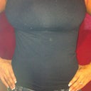 2 weeks post op and 1 Day

wearing Jeans