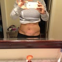 One week later...a lot of swelling, still struggling to stand up straight