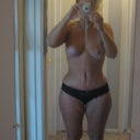 20 days post op