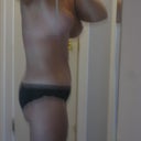 20 days post op